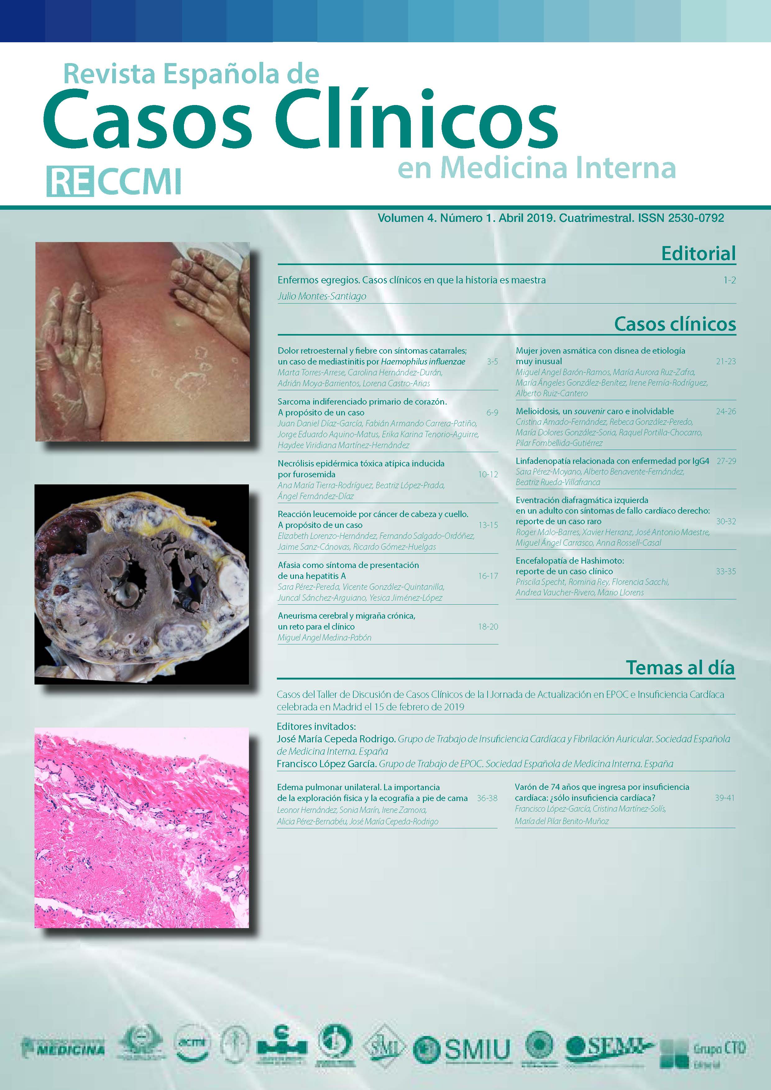 					Ver Vol. 4 Núm. 1 (2019): Revista Española de Casos Clínicos en Medicina Interna
				