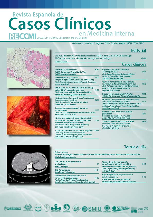 					Ver Vol. 4 Núm. 2 (2019): Revista Española de Casos Clínicos en Medicina Interna
				