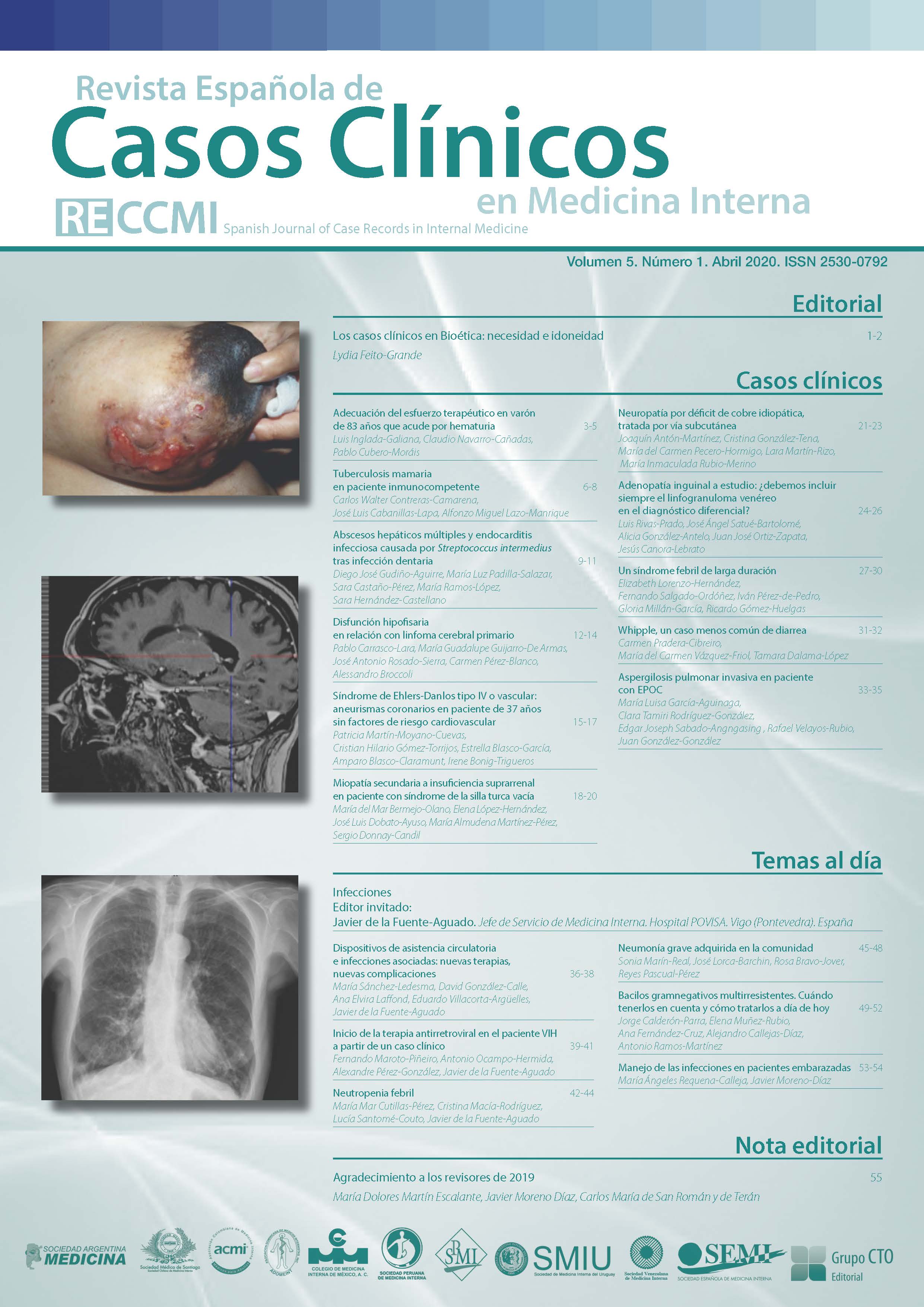 					Ver Vol. 5 Núm. 1 (2020): Revista Española de Casos Clínicos en Medicina Interna
				