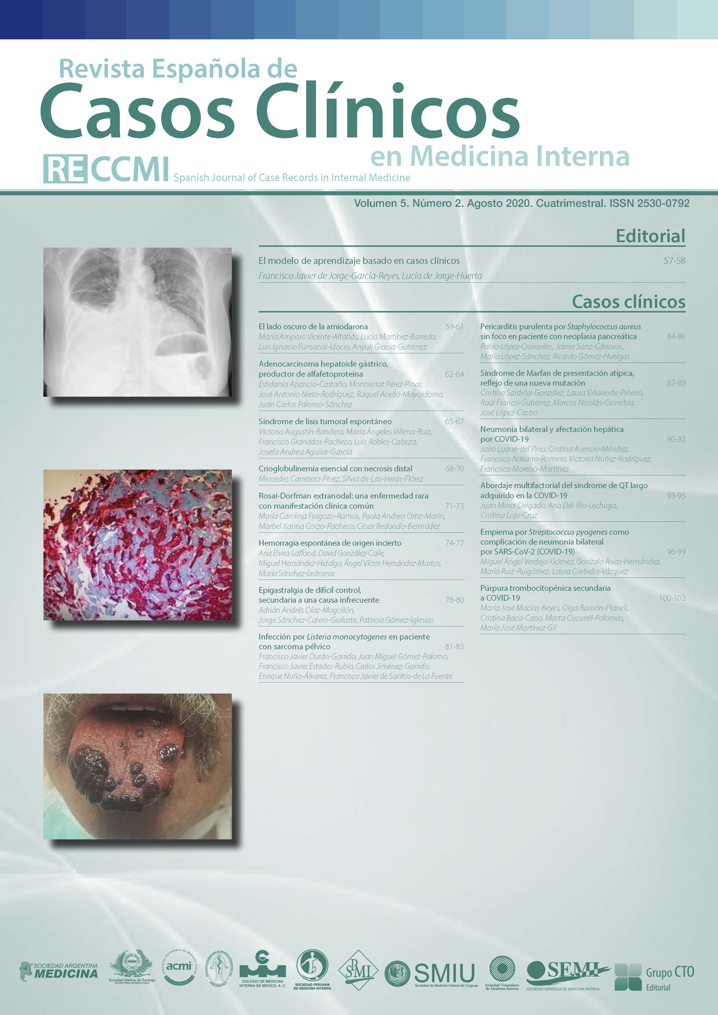 					Ver Vol. 5 Núm. 2 (2020): Revista Española de Casos Clínicos en Medicina Interna
				