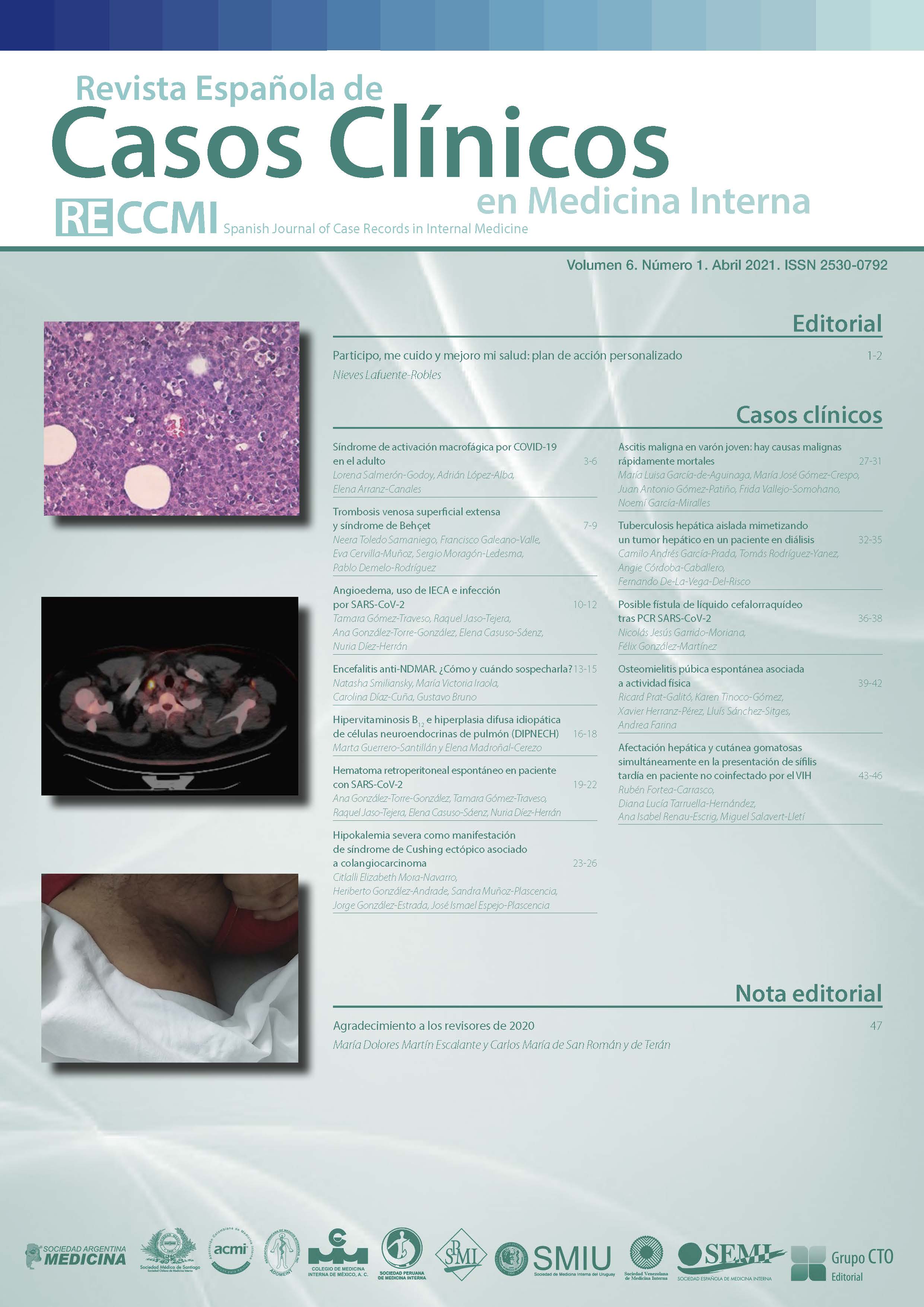 					Ver Vol. 6 Núm. 1 (2021): Revista Española de Casos Clínicos en Medicina Interna
				