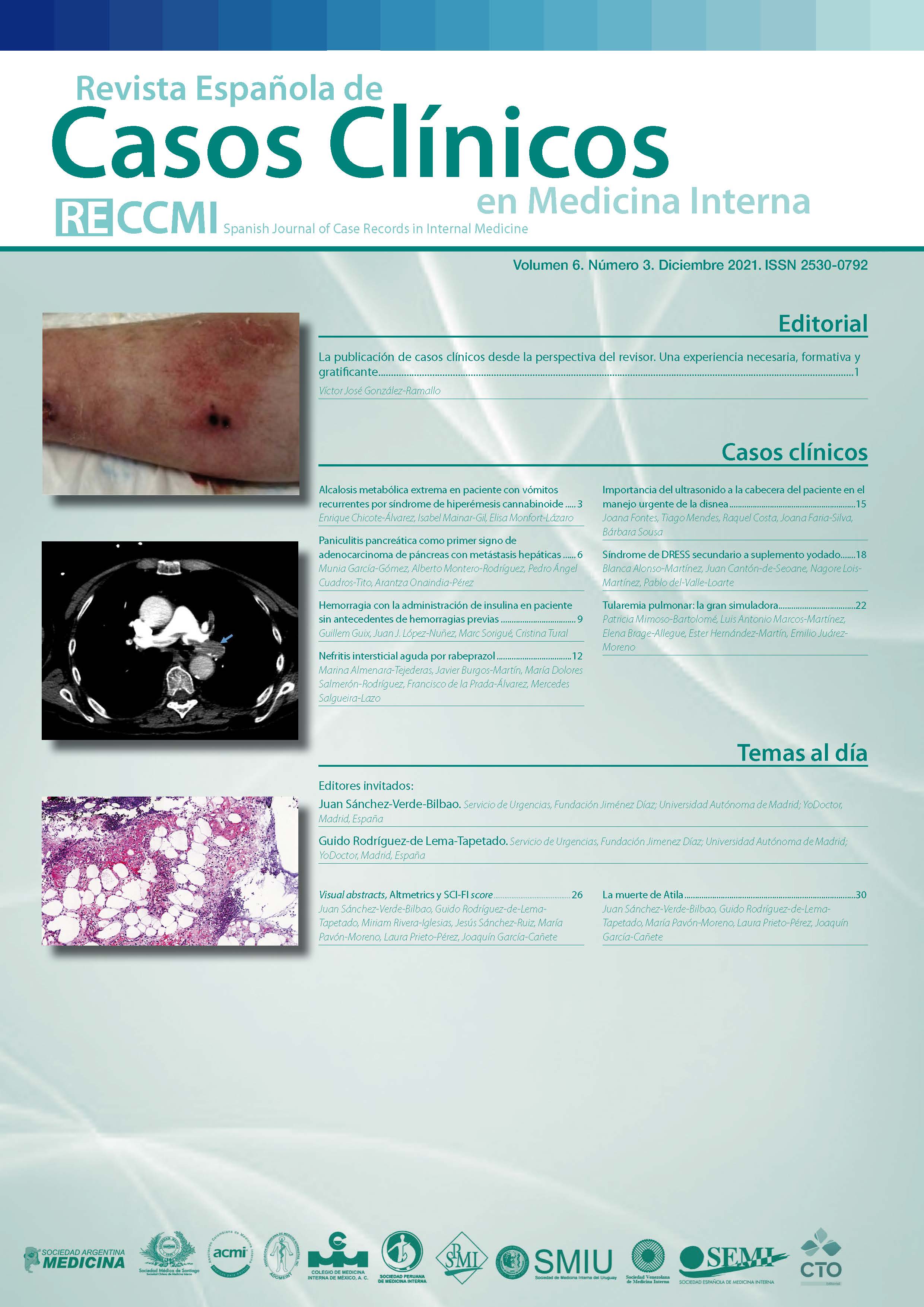 					Ver Vol. 6 Núm. 3 (2021): Revista Española de Casos Clínicos en Medicina Interna
				