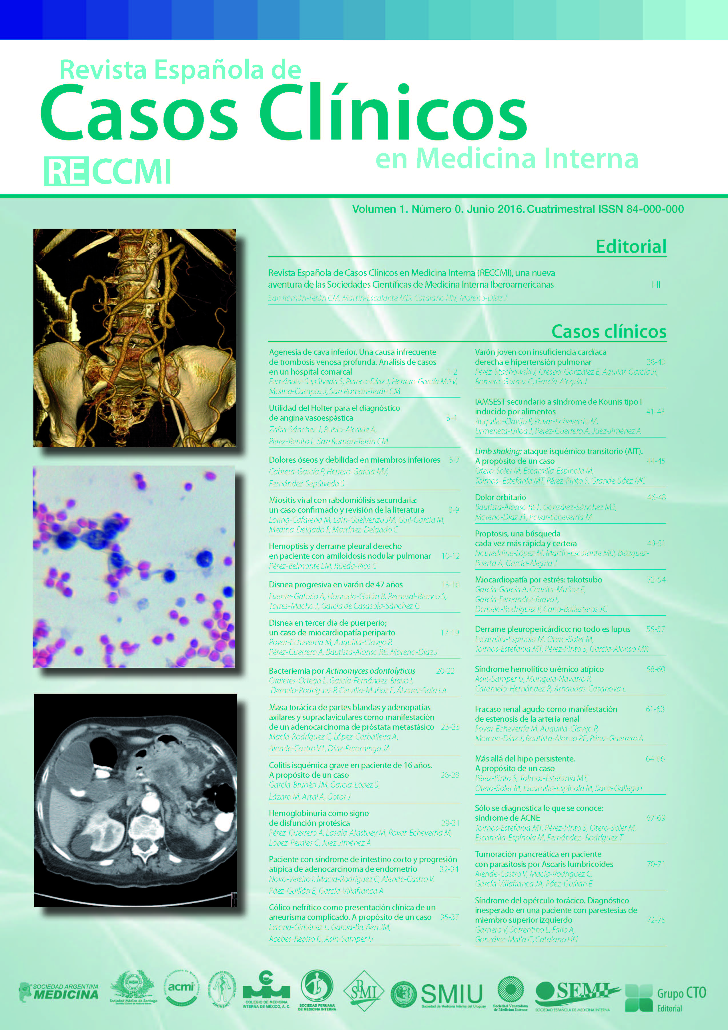 					Ver Vol. 1 (2016): Revista Española de Casos Clínicos en Medicina Interna
				