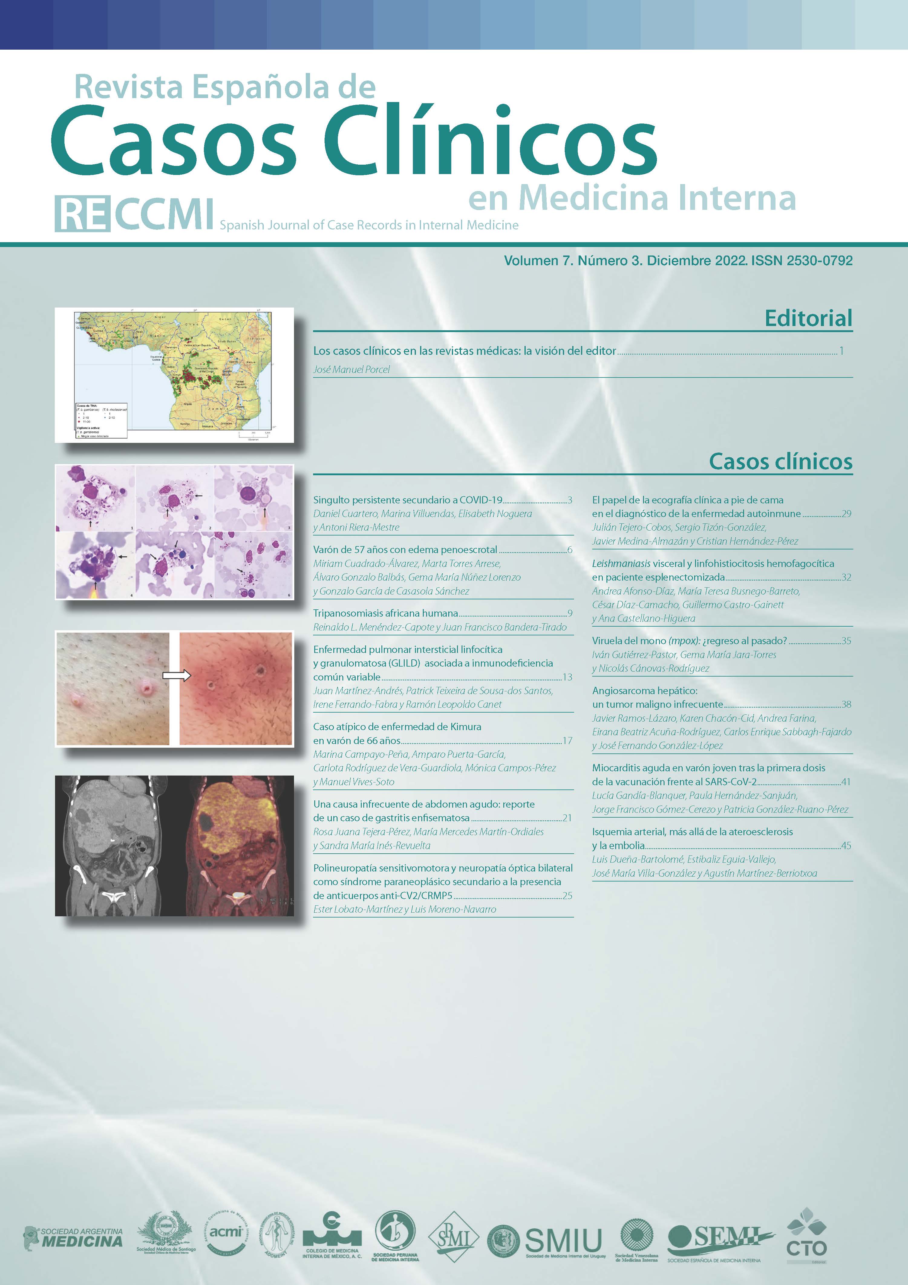 					Ver Vol. 7 Núm. 3 (2022): Revista Española de Casos Clínicos en Medicina Interna
				