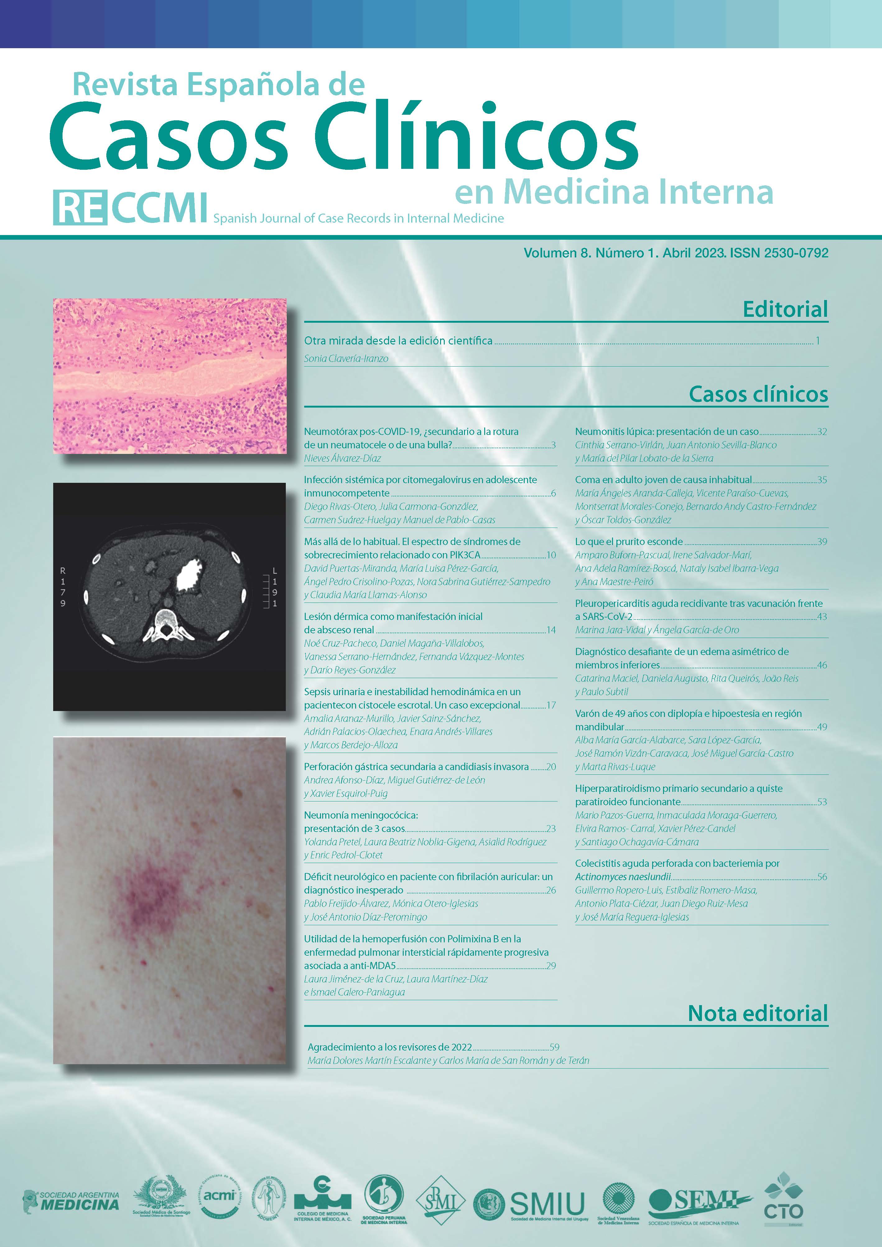 					Ver Vol. 8 Núm. 1 (2023): Revista Española de Casos Clínicos en Medicina Interna
				