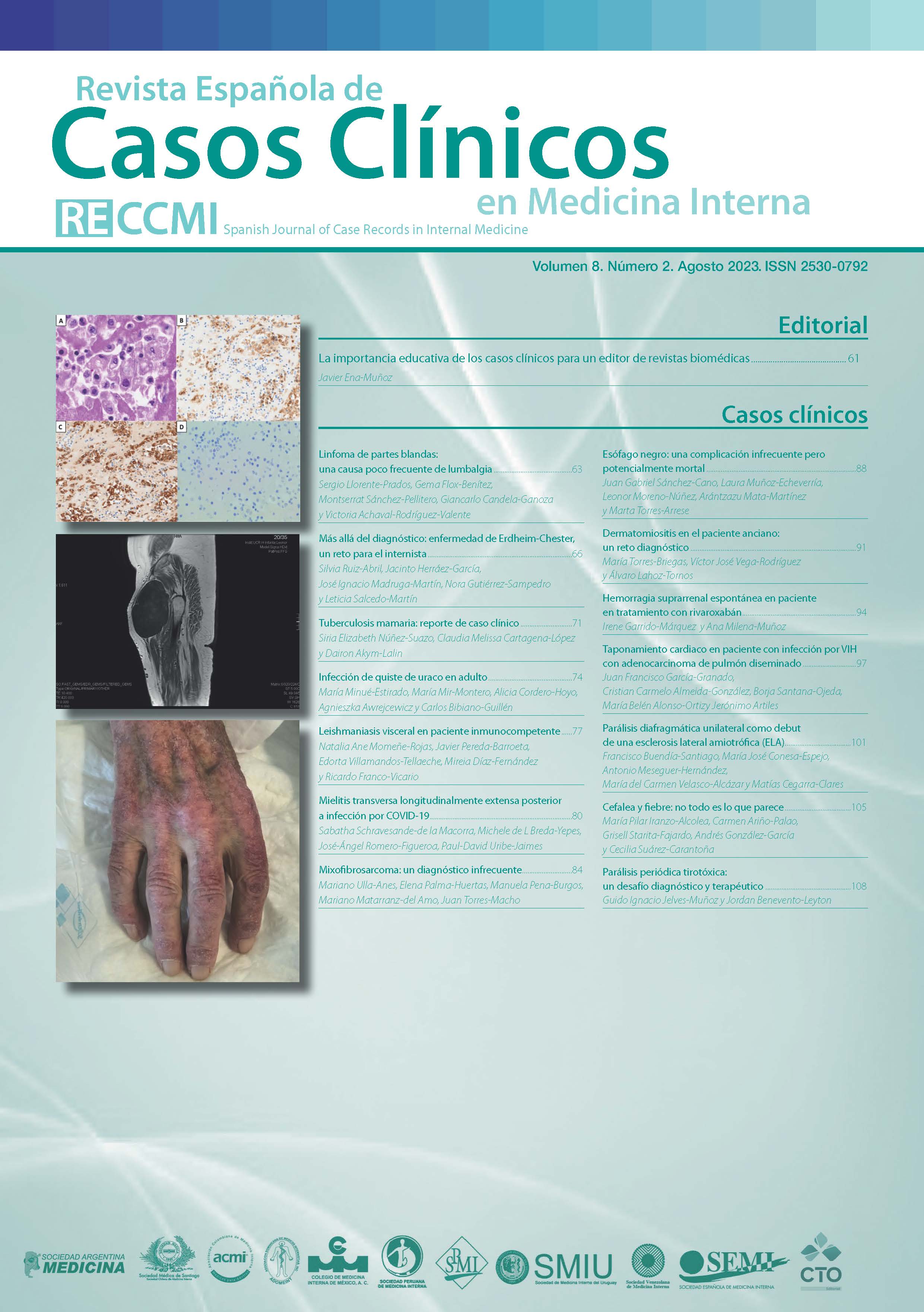 					View Vol. 8 No. 2 (2023): Revista Española de Casos Clínicos en Medicina Interna
				