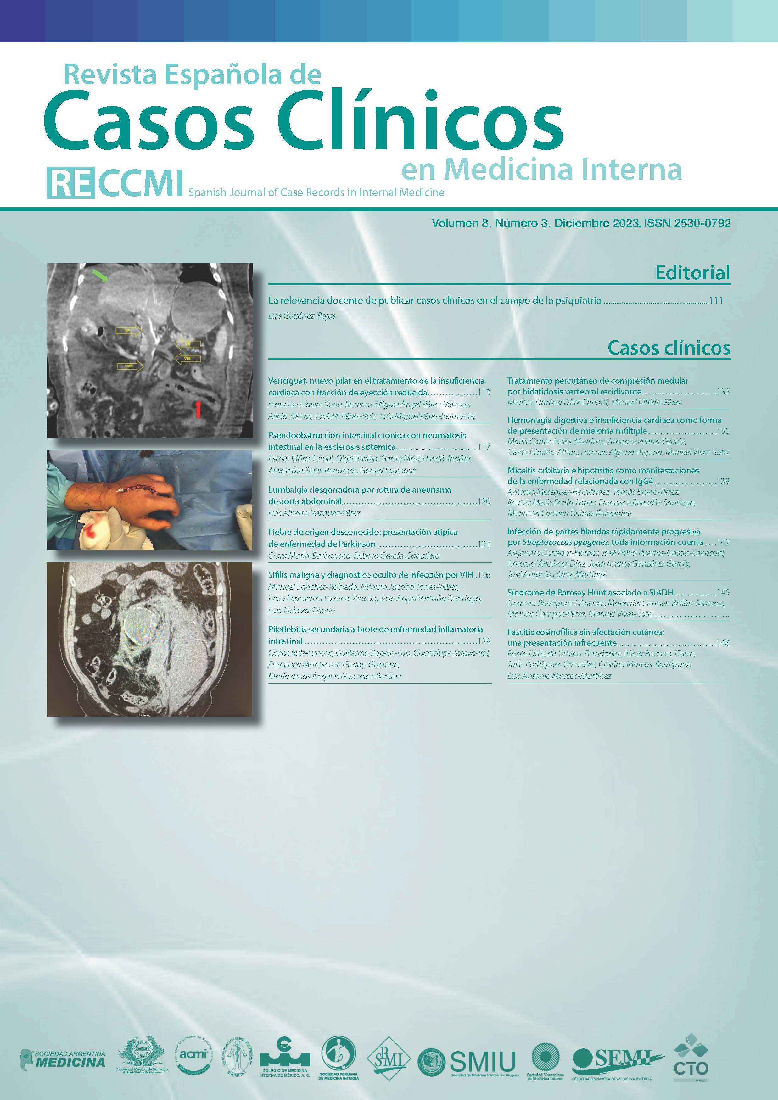 					Ver Vol. 8 Núm. 3 (2023): Revista Española de Casos Clínicos en Medicina Interna
				
