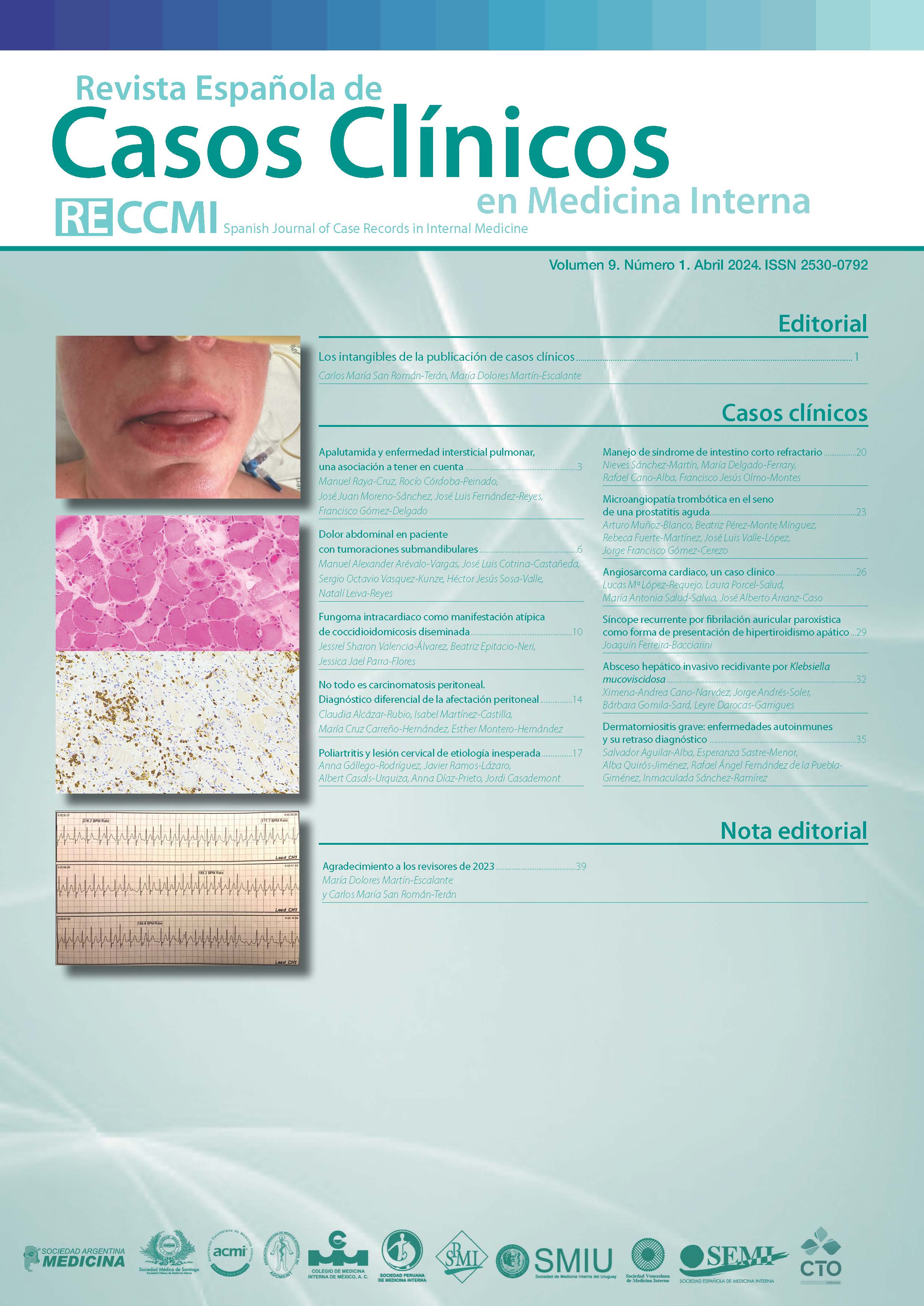 					Ver Vol. 9 Núm. 1 (2024): Revista Española de Casos Clínicos en Medicina Interna 
				
