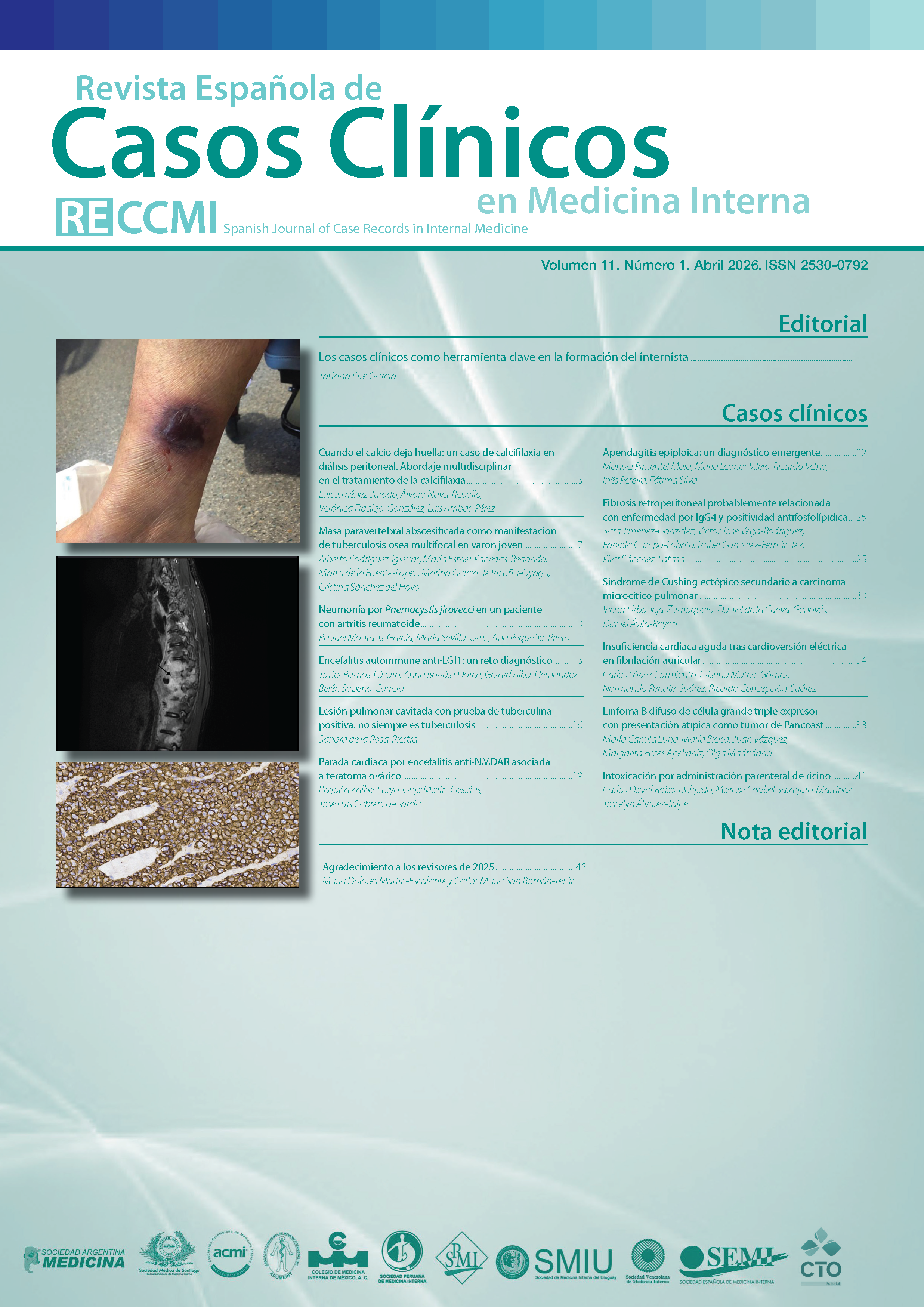 					Ver Vol. 11 Núm. 1 (2026): Revista Española de Casos Clínicos en Medicina Interna
				