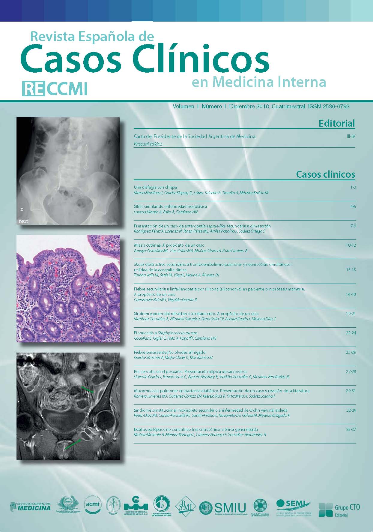 					Ver Vol. 1 Núm. 1 (2016): Revista Española de Casos Clínicos en Medicina Interna
				